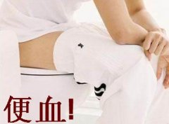 便血出现的原因以及检查